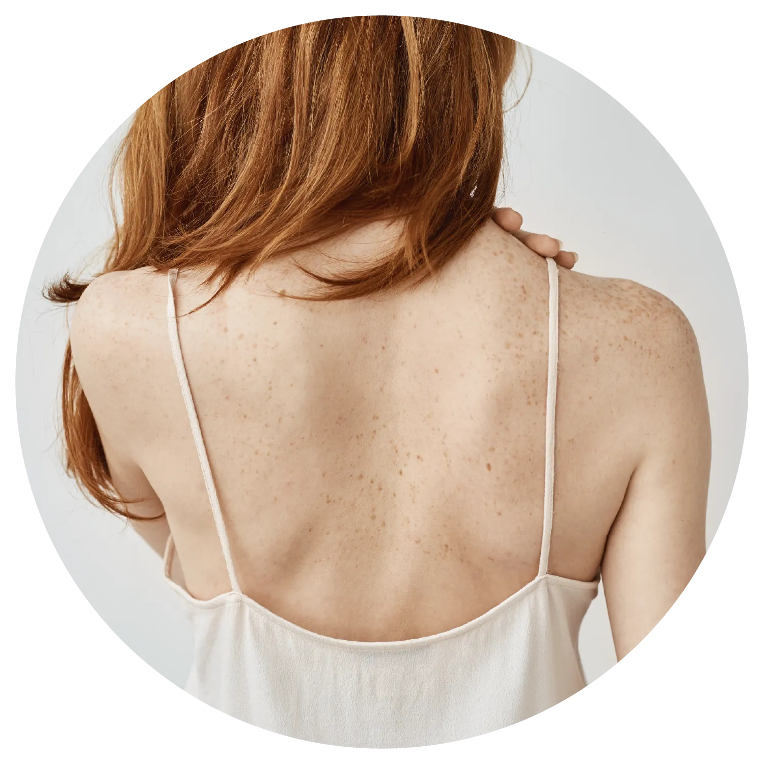 Back Acne treatment results at Toronto medical spa - The Chain Reaction of Symptoms